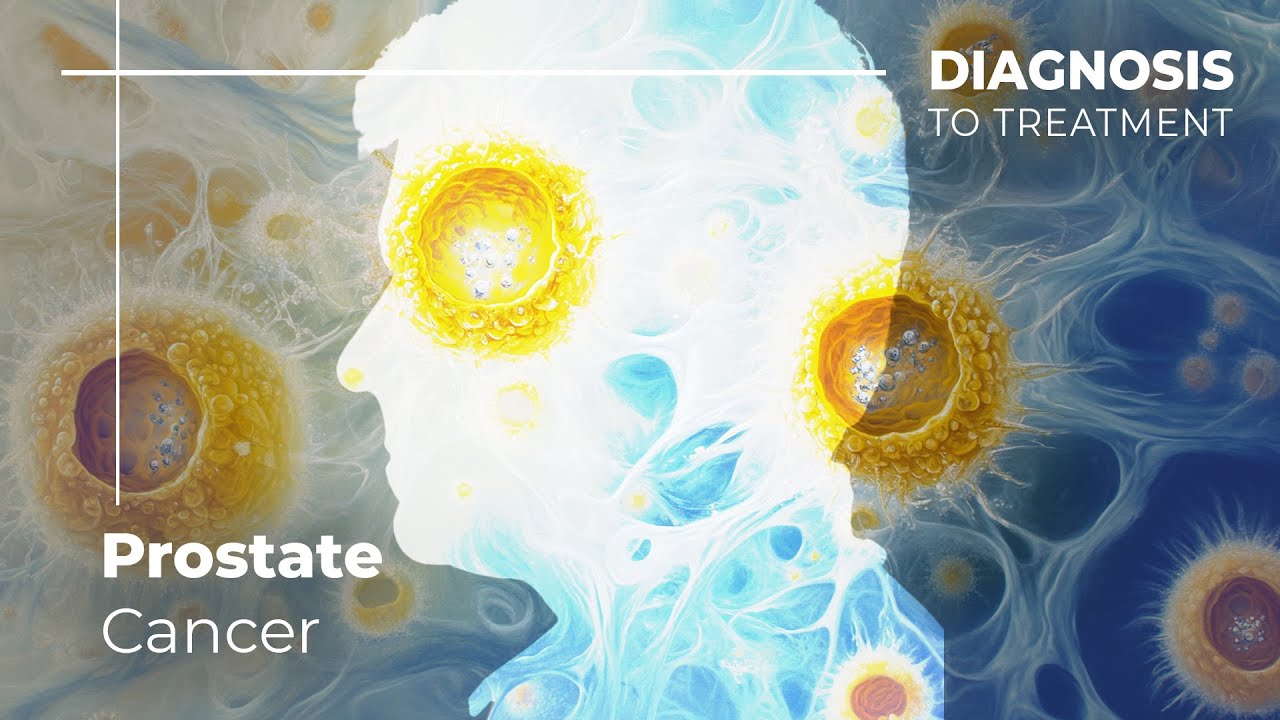 Understanding Prostate Cancer: Symptoms, Diagnosis, and Clinical Trial Options