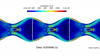 OpenFOAM® - Peristaltic Transport of A Soft Particle through A Periodic Channel