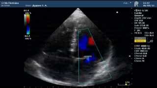 ⁣Ультразвуковое исследование сердца