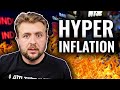 The Painful Truth About Hyperinflation...