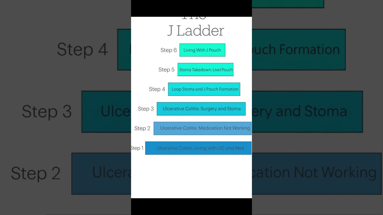 UC to J Pouch: The J Ladder Journey