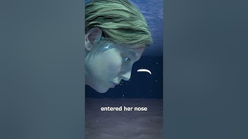 Leeches Inside Your Body? 😨