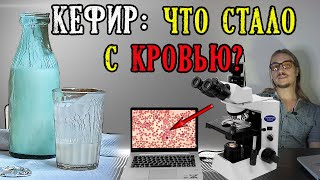 Кефир: что стало с кровью под микроскопом?