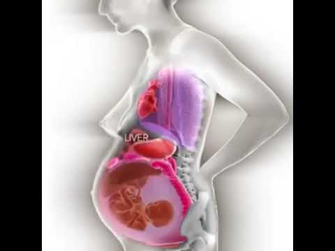 Pin on Healthcare & Ultrasound