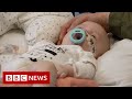World's most expensive medicine treats infants with genetic disorder - BBC News