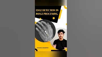 Edge Detection in Image Processing