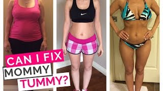 Mommy Tummy Fix | Can I Fix My Mummy Tummy Even If It's Been Awhile After Pregnancy?