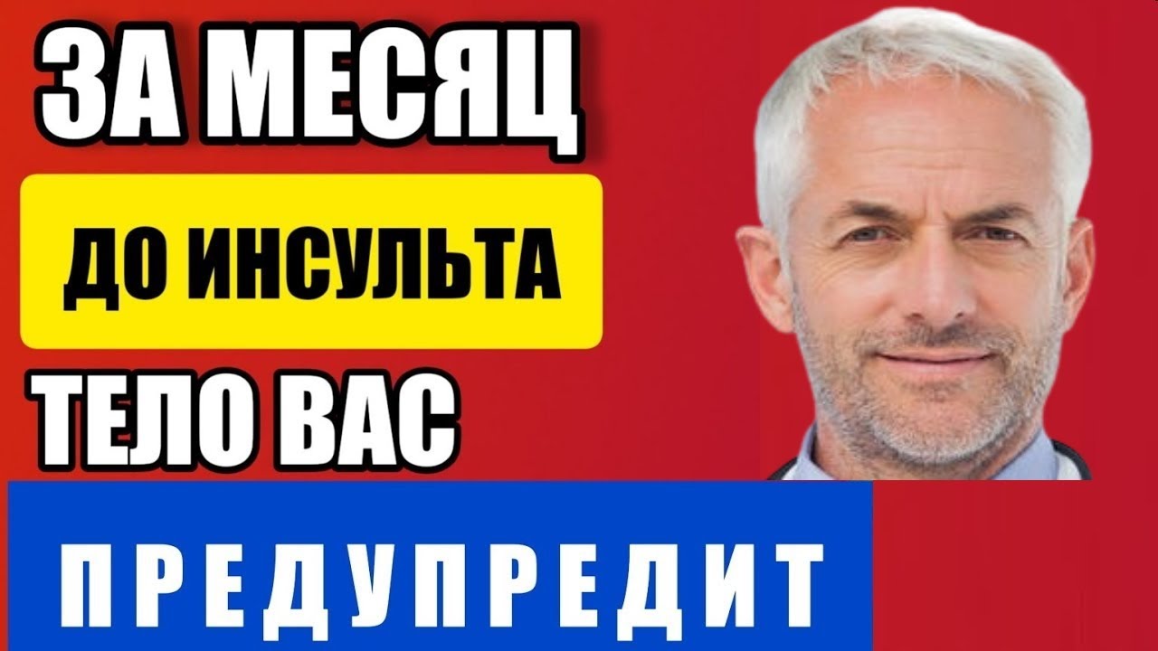 Ученые назвали 7 условий снижения риска инсульта