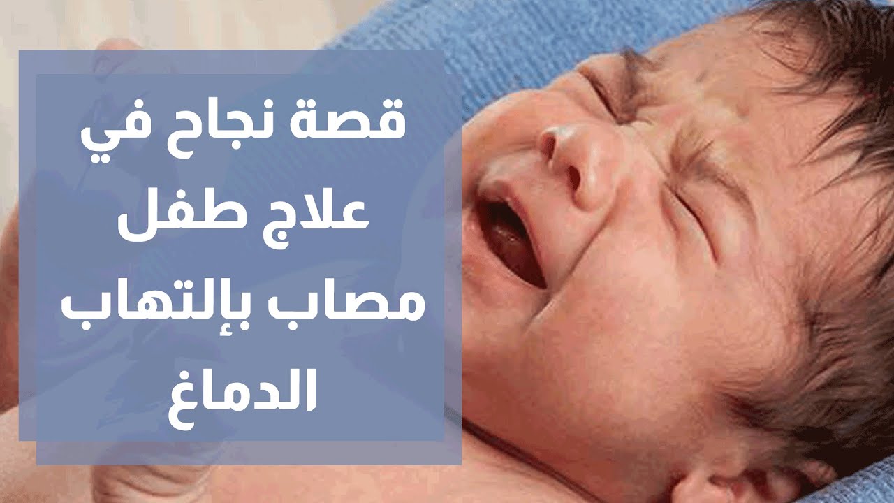 قصة نجاح في علاج طفل مصاب بإلتهاب حاد في الدماغ