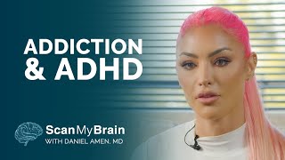 Natalie Eva Marie: Her Journey Through Addiction, Sobriety & ADHD by AmenClinics 4,027 views 3 months ago 15 minutes