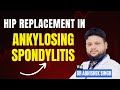 Ankylosing Spondylitis &amp; Total Hip Replacement: Expert Guide by Dr. Abhishek Singh