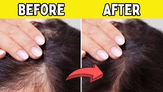 ONLY 1 Secret INGREDIENT to Shiny, Healthy Locks - Unlock The Magic Ingredient by Debongo 61 views 2 months ago 2 minutes, 9 seconds