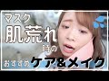 【今話題の"シカ"クリームってどう？】マスク荒れ時のおすすめスキンケア&メイク