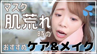 【今話題の"シカ"クリームってどう？】マスク荒れ時のおすすめスキンケア&メイク