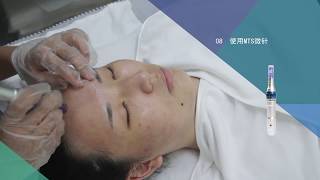 韩国皮肤管理——MTS微针管理（Microneedle Therapy System）LEIM Skincare