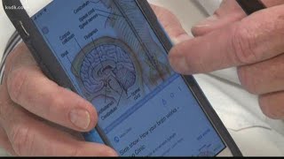 Using an app to diagnose concussions? FDA says that's a bad idea.