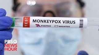 How a new national emergency declaration could slow the spread of monkeypox