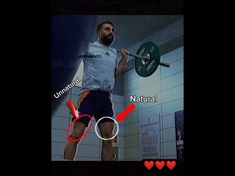 عودة داني كارفاخال الى التدرييات وحصلت اصابة مؤلمة بعد الرباط الصليبي