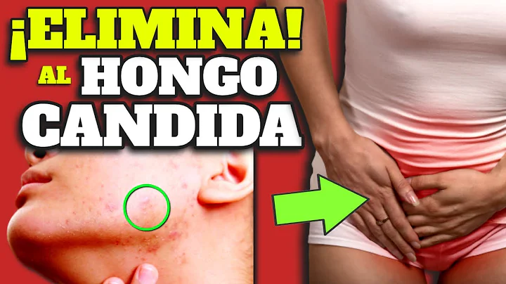 IMPRESIONANTE!: As DESTRUIS a la CANDIDA de tu CUERPO| NUNCA MS TENDRS CANDIDIASIS