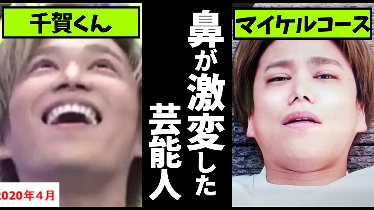 【ガルちゃん】整形？成長？肥大化？鼻が変わりすぎてビビった芸能人教えてｗ【有益2ch】