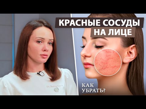 Как убрать покраснения на лице?