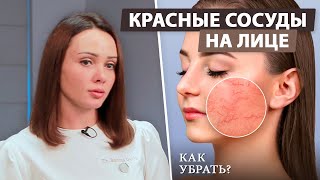 Как убрать покраснения на лице?