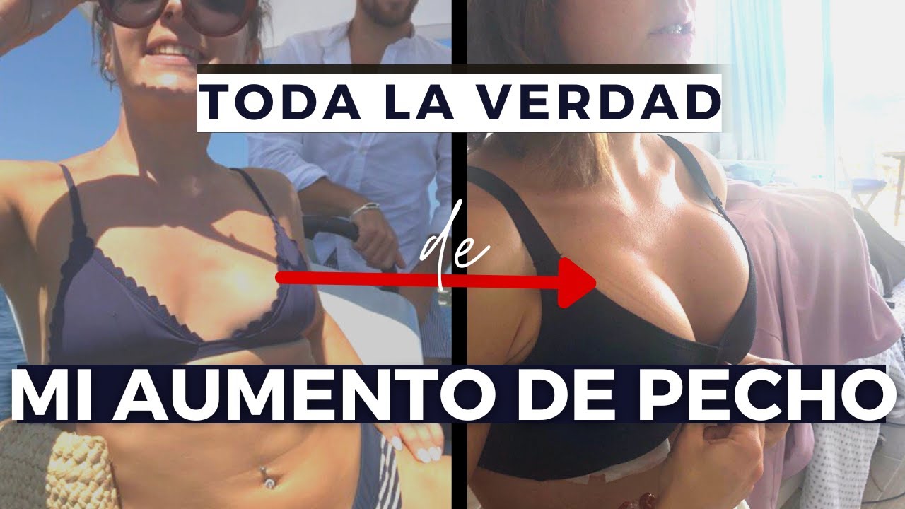 Experiencia de mi Operación para AUMENTO DE PECHO | consejos para el dolor | cómo es la recuperación