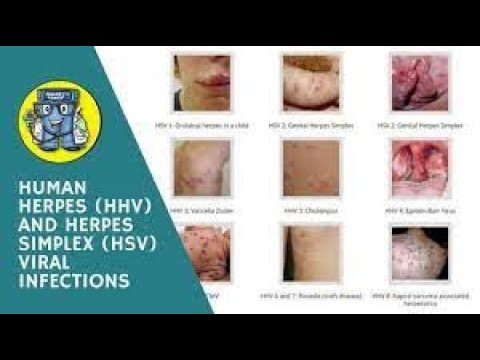 Video: Dezvăluirea Primilor Pași Cheie în Patogeneza Cu Herpesvirus Equin De Tip 5 (EHV5) Folosind Modele Ex Vivo și Ecine In Vitro