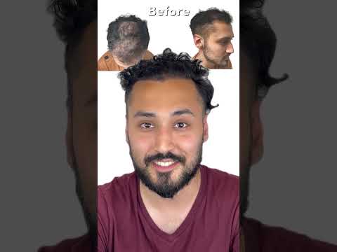 Another super satisfied client! That’s what we do here at Maxim—we build it, and the hair will come.