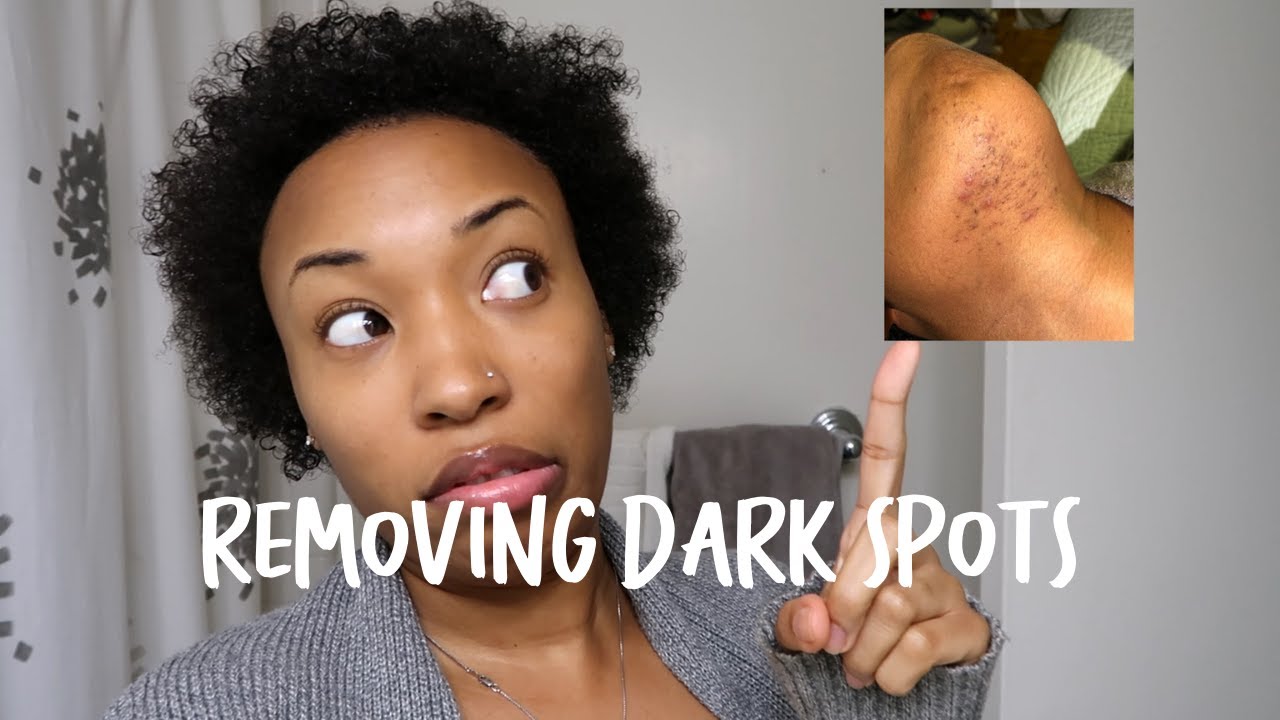 How to Clear Up Dark Spots | Removing Dark Spots on Your Face | Earthen