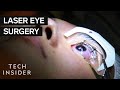 What It&#39;s Like To Get Laser Eye Surgery