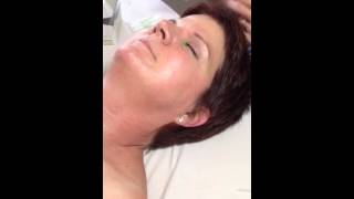 Corrugator muscle needling