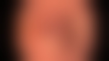 Direct Cholangioscopy