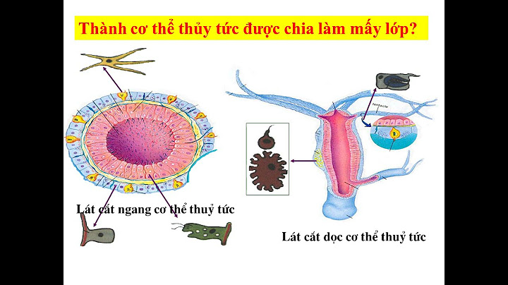 Thành cơ thể của thủy tức san hô hải quỳ sứa có bào nhiều lớp tế bào