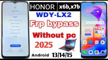 FRP Bypass Honor X6B / X7B Without PC (2025) | 100% Working Method