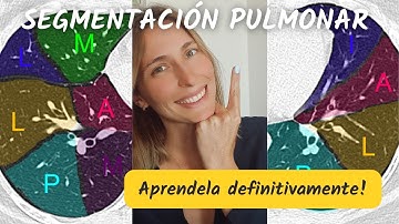 Basta de pelear con la segmentación pulmonar! Te cuento cómo aprenderla definitivamente!✔️