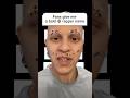 Can you give me a bald rapper name? 👨🏽🦲✨ #comedy #funny #alopecia