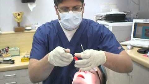 How to custom adjust a hard acrylic diagnostic or therapeutic dental bite splint using a leaf gauge