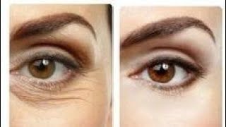 علاج الهالات السوداء والتجاعيد Treatment of dark circles and wrinkles