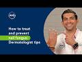 How to treat and prevent nail fungus: Dermatologist tips