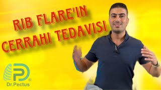 Rib Flare'ın cerrahi tedavisi nedir, nasıl gerçekleştirilir? Doç. Dr. Hasan Ersöz cevaplıyor!