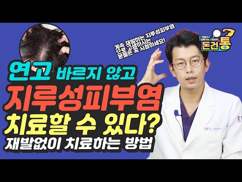 How to fix Scaly Scalp(seborrheic dermatitis)naturally연고 바르지 않고 지루성 피부염, 지루성두피염 치료할수있다? 탈모생기는지루성피부염