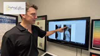 Neck Pain Doctors in Franklin WI
