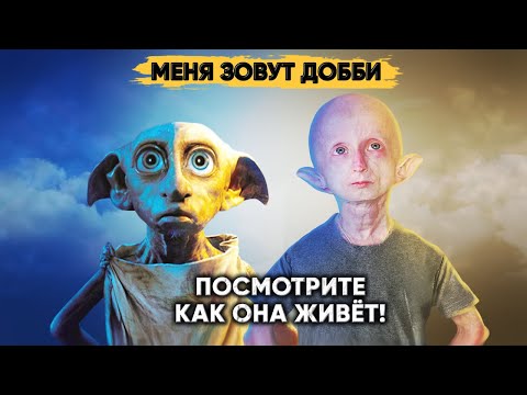 DOBBY IN REAL LIFE. An amazing story of a girl from Siberia.