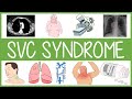 Superior Vena Cava Syndrome in 3 Minutes