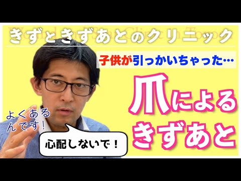 よくある爪の引っかき傷の治療方法、ケアを教えます。