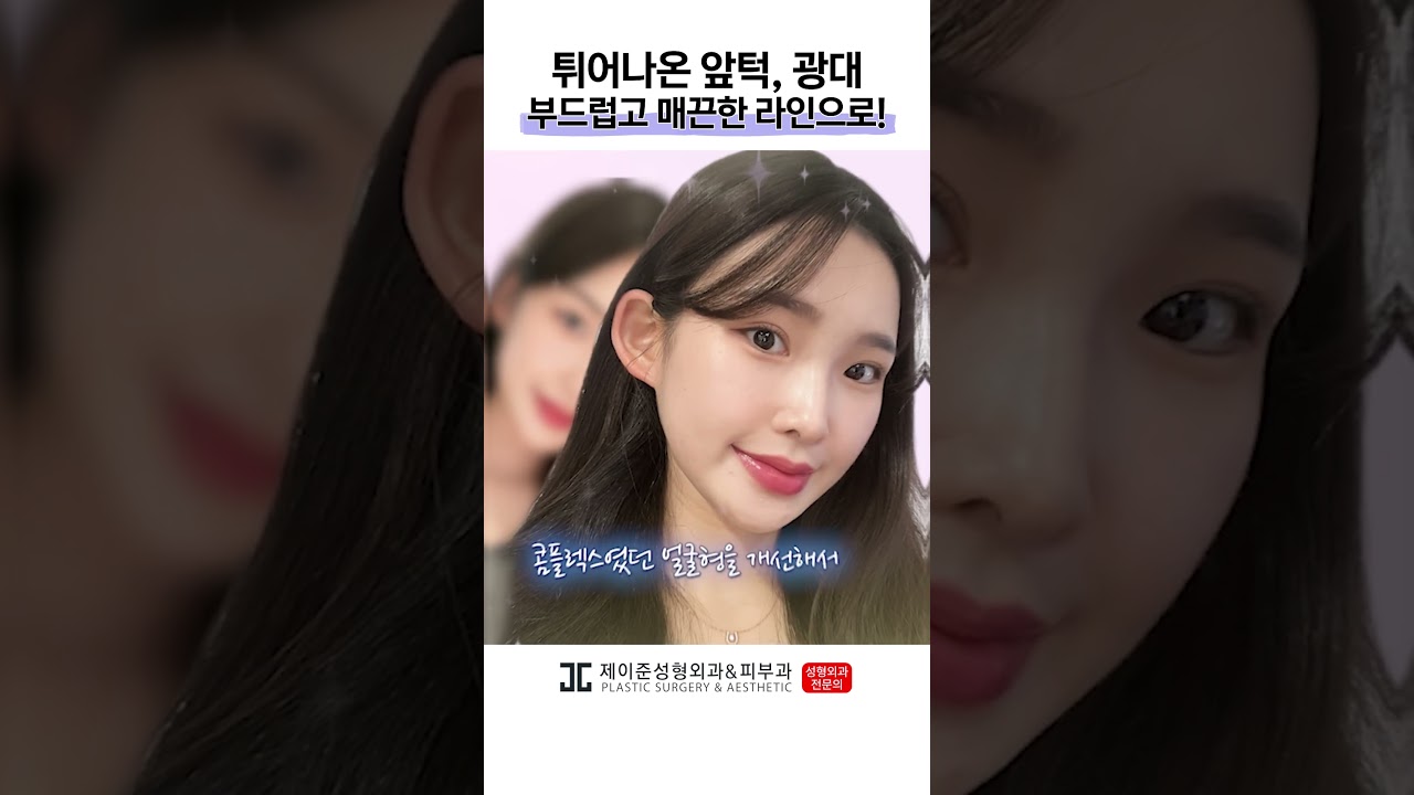 [Phẫu thuật thẩm mỹ & Da liễu Jayjun] Giải quyết nỗi tự ti về khuôn mặt! #shorts