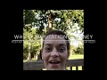 Above Knee Amputee - Post-Op Update, All the Good Stuff, & Enlisting Your Help!