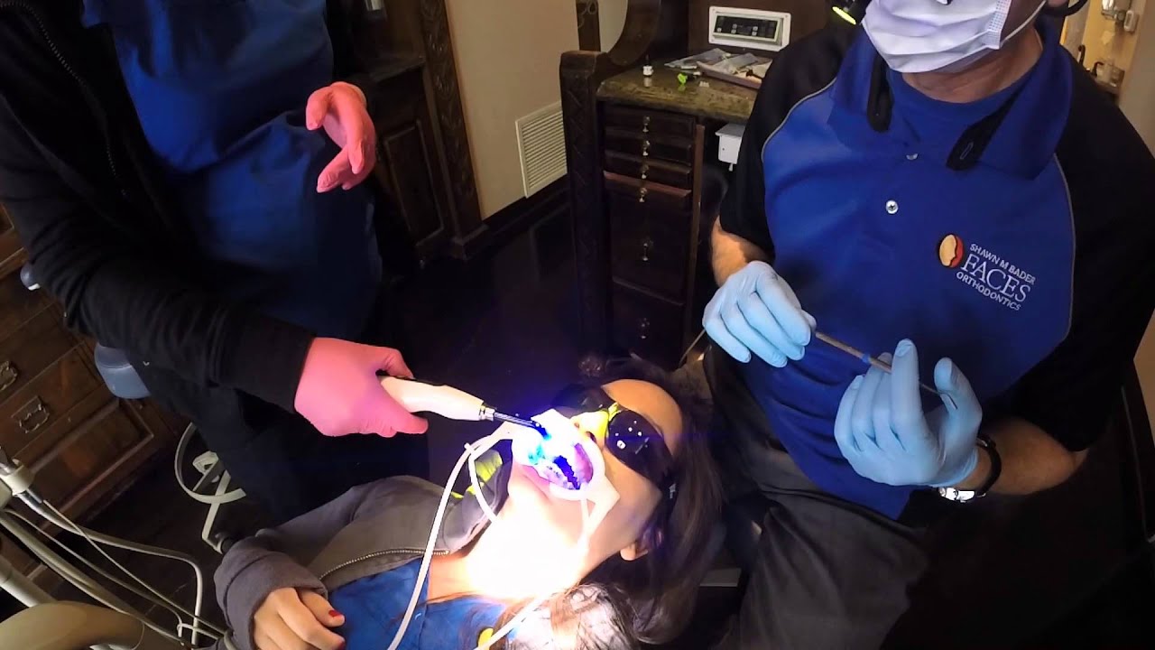 Placing Insignia Braces - Scottsdale Orthodontist - Faces Orthodontics