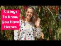 3 Ways To Know You Have Herpes - Life With Herpes